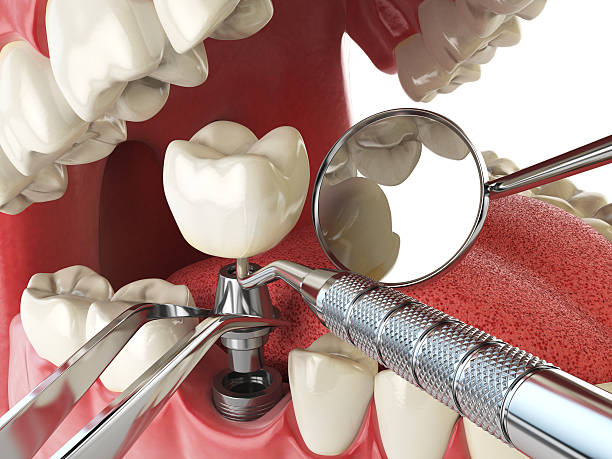 Best Cracked Tooth Emergency Dentist  in Ohioville, PA